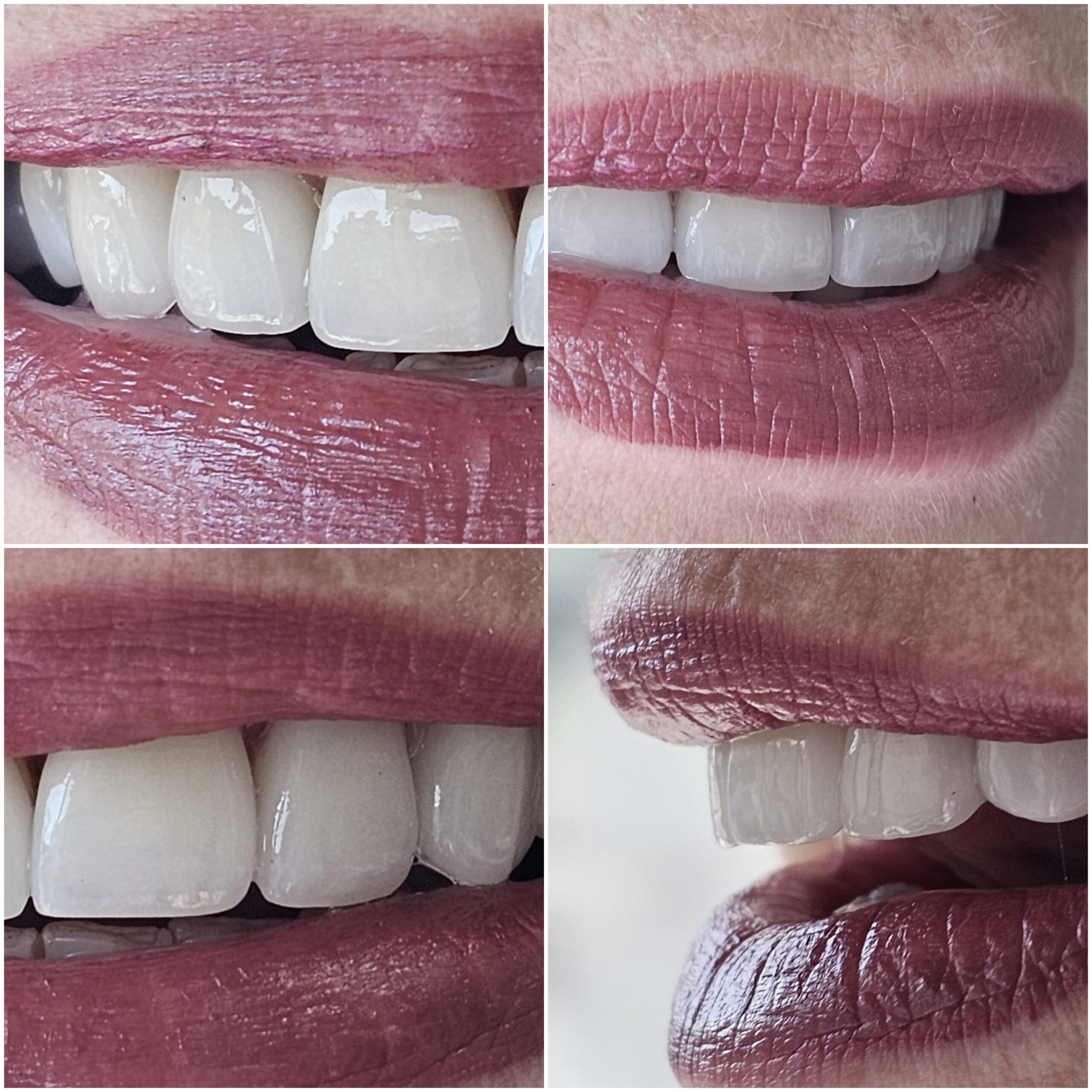 Estetica dentară 8 image00006