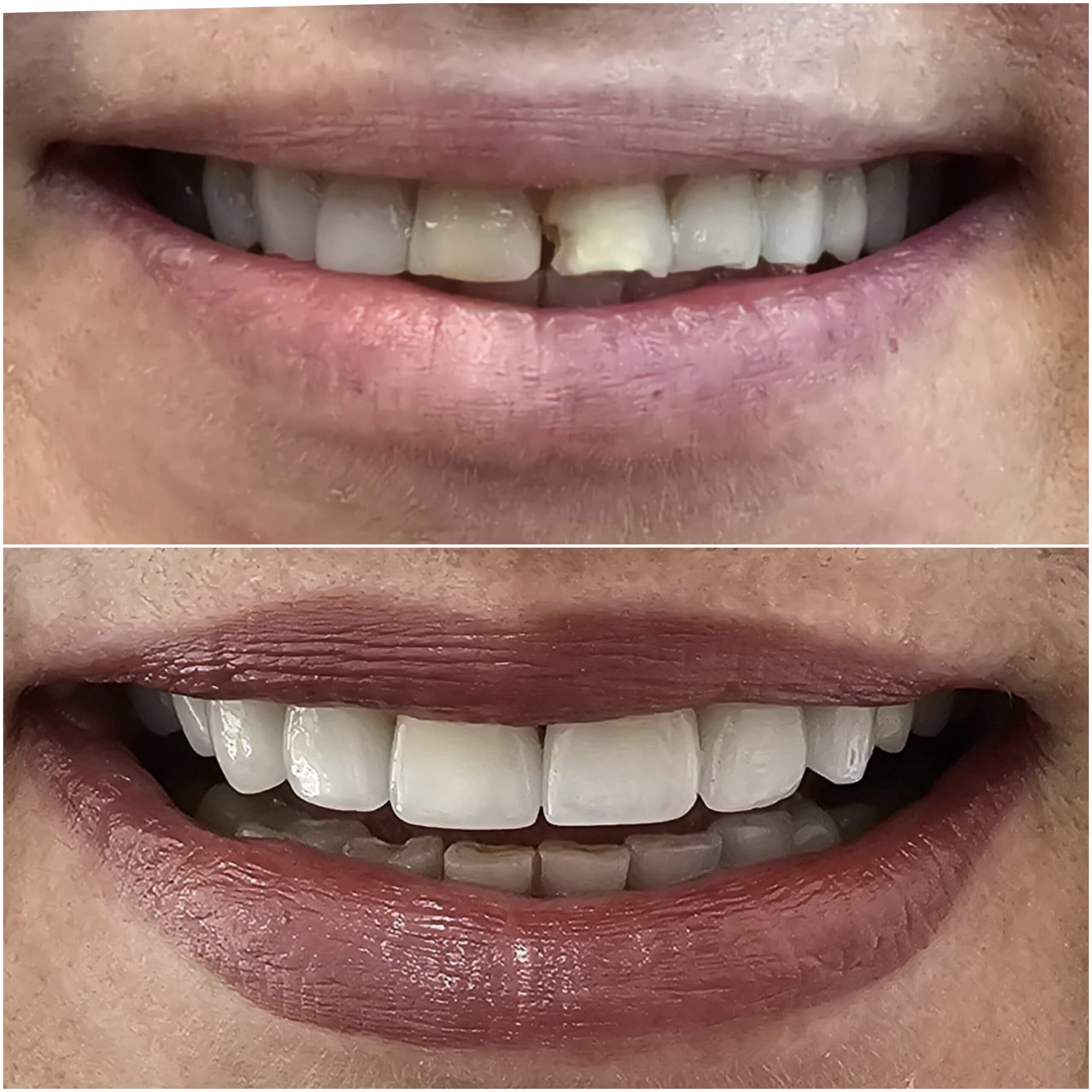 Estetica dentară 5 image00007